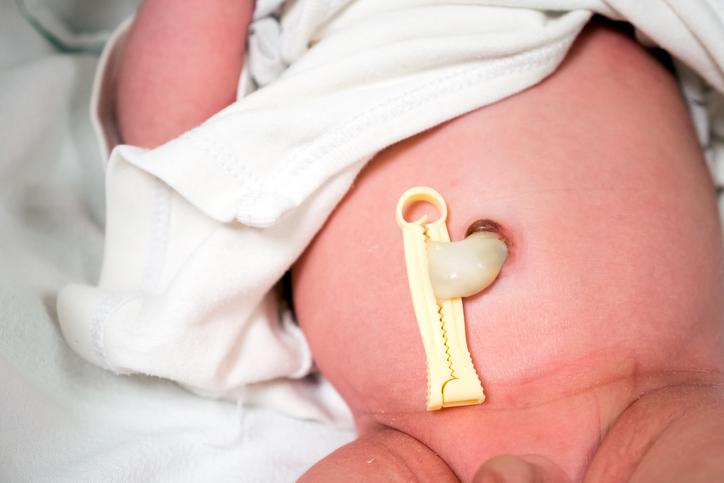 Quando o cordão umbilical do bebê cai