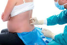 Quando eles colocam a epidural em uma entrega induzida