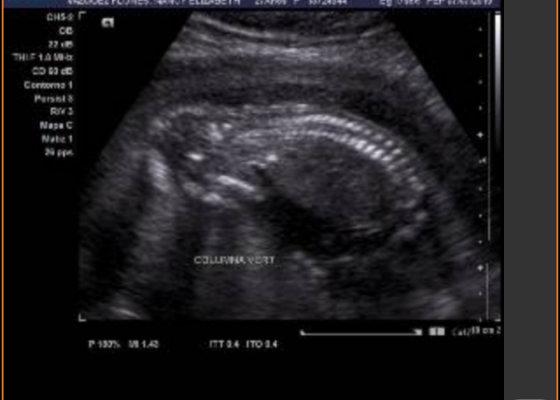 Devo me preocupar se meu bebê é boca do ultrassom?