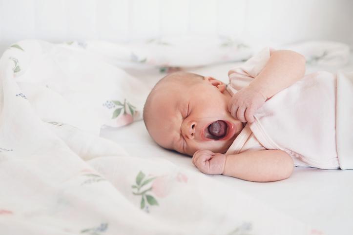 Muguet ou candidíase oral em bebês: o que é