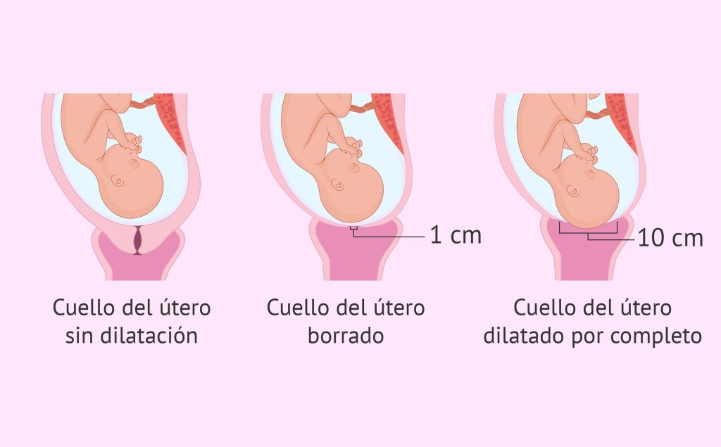 O que é a exclusão cervical e como medi -la